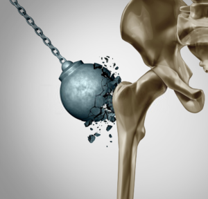 bone mass
