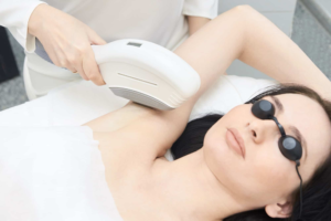 Laser Hair Removal