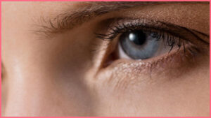 Trough Fillers Treatment