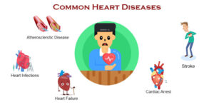 Common Heart Diseases