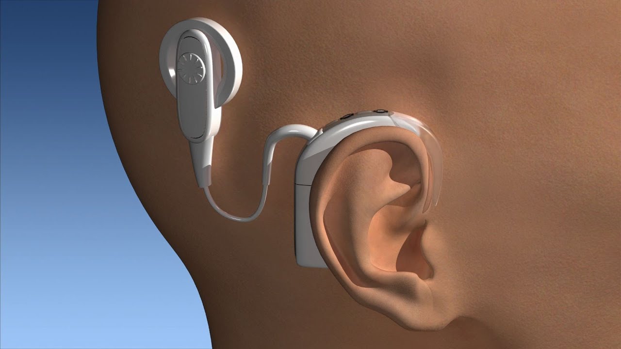 Right Hearing Aid