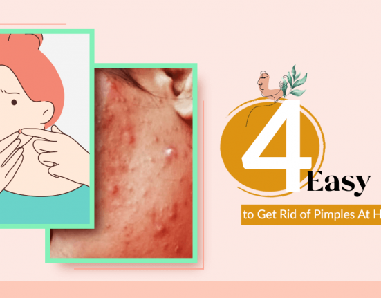 4 Easy Ways to Get Rid of Pimples at Home Overnight