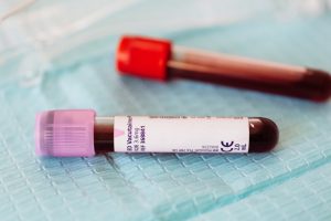 Blood Testing for Your Health