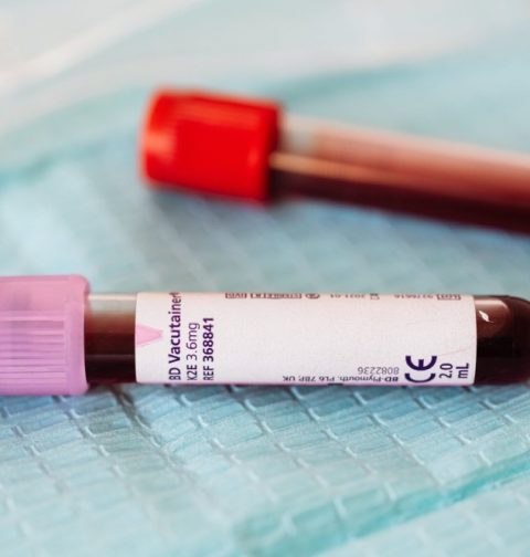 Blood Testing for Your Health