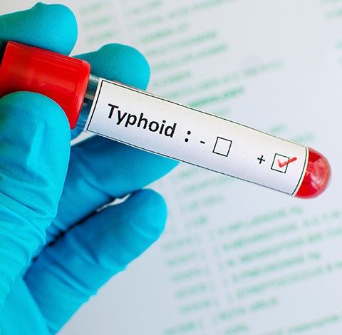 Typhoid