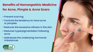 Benefits-of-Homeopathic-Medicine-for-Acne,-Pimple-&-Acne-Scars