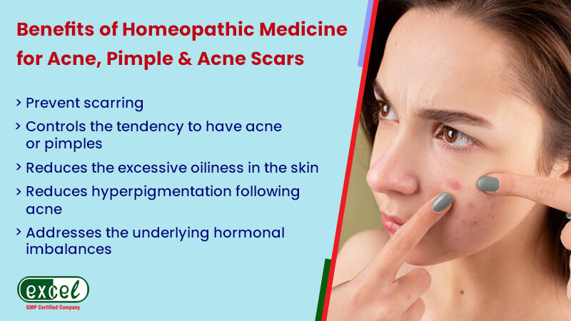 Benefits-of-Homeopathic-Medicine-for-Acne,-Pimple-&-Acne-Scars