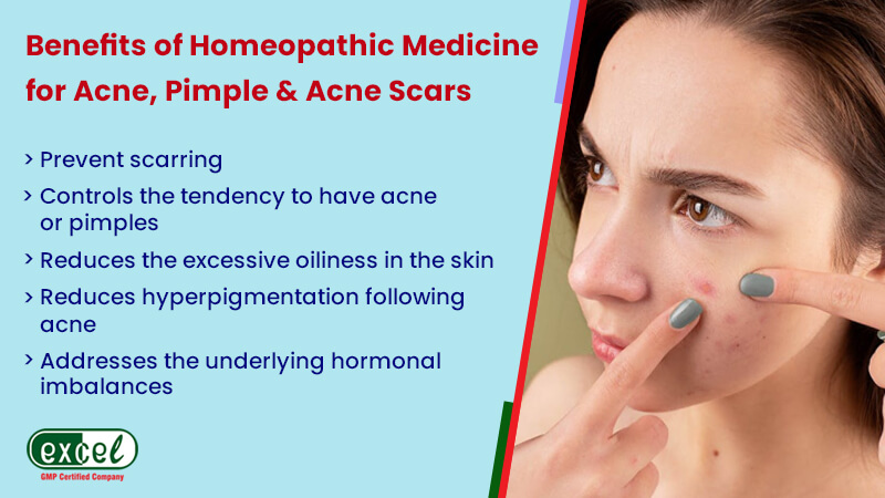 Tired of the Acne Problems? Try Homeopathic Medicines! - Excelebiz