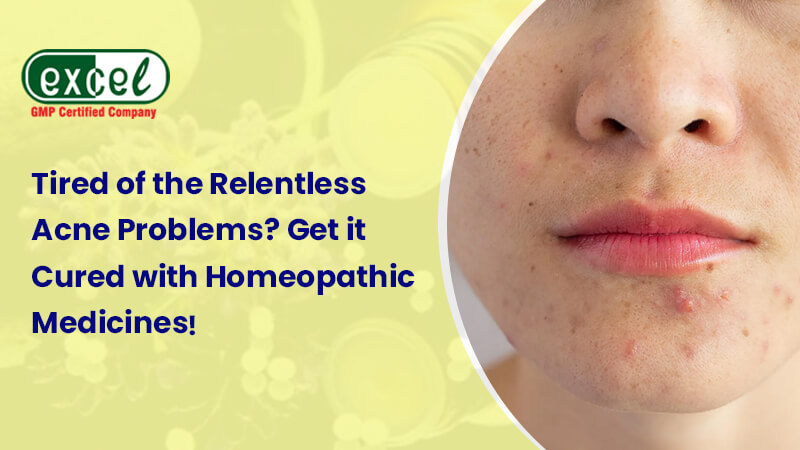 Homeopathic medicines for acne, pimples & acne scars