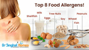 Homeopathic Medicines for Allergies
