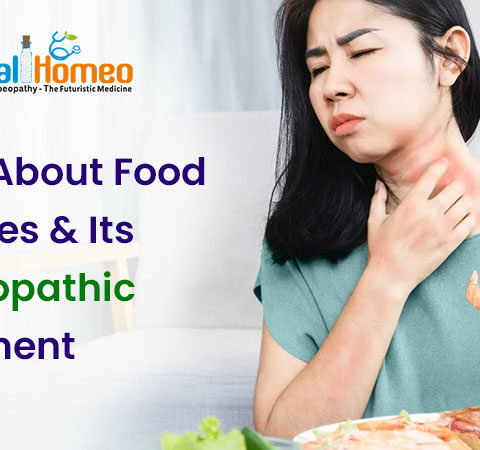 Food Allergy Treatment in Homeopathy