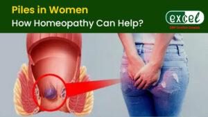 Homeopathic Medicine for Piles