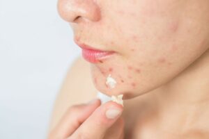 best skin care products in Pakistan