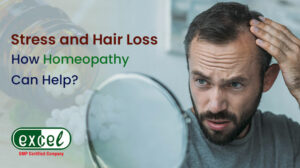 Stress and Hair Loss - How Homeopathy Can Help?