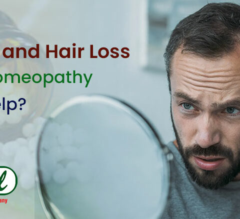 Stress and Hair Loss - How Homeopathy Can Help?